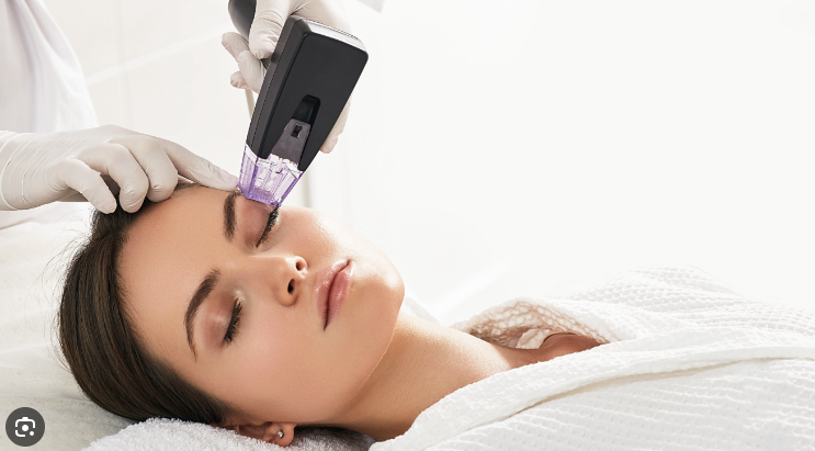 under eye treatment morpheus8