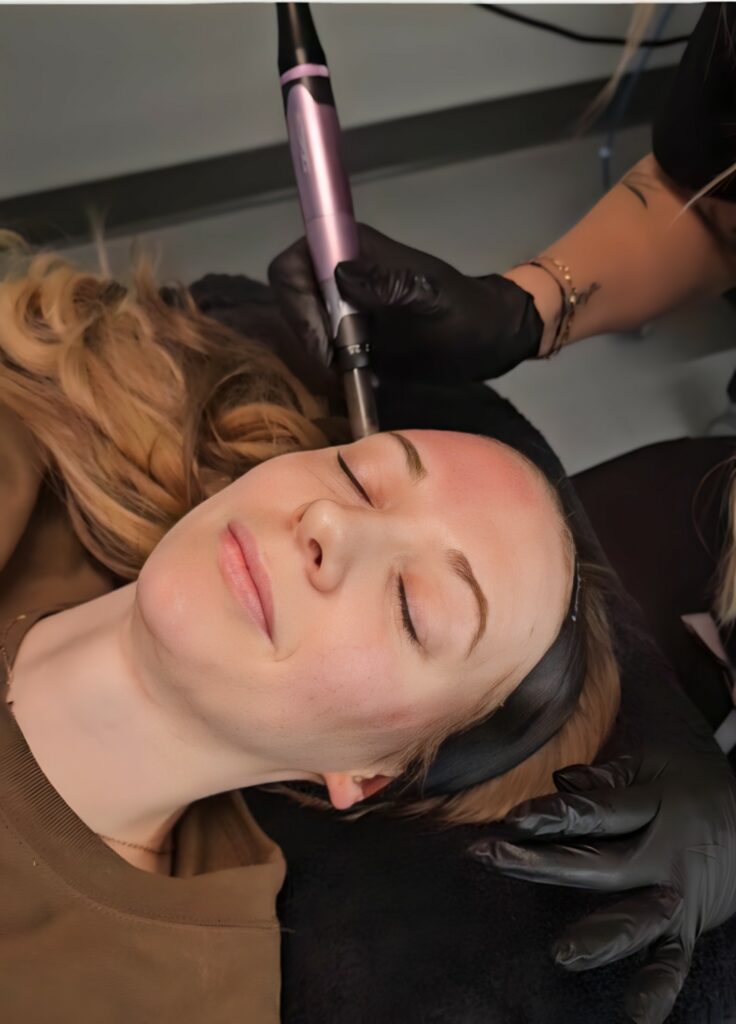 Microneedling treatment being performed at Pine & River Aesthetics in Little Rock, Arkansas to improve skin texture, tone, and collagen production.